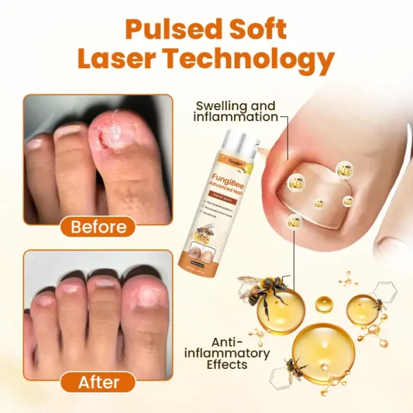 Timilk® FungiBee Advanced Nail Repair Spray