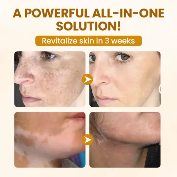 Timilk® BeeVenom Complex Repair Cream