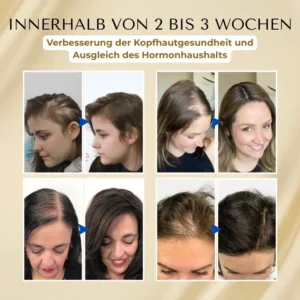Timilk® VitaStrand Biotin Haarwachstumsspray✅Dichtes, glänzendes Haar in nur wenigen Wochen