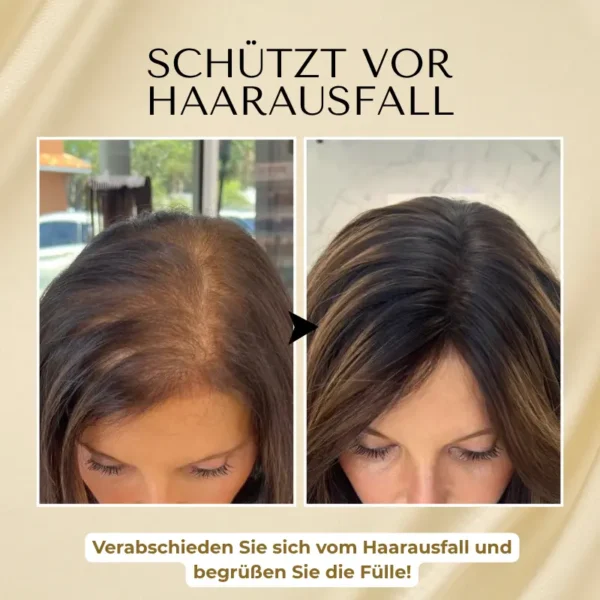 Timilk® VitaStrand Biotin Haarwachstumsspray✅Dichtes, glänzendes Haar in nur wenigen Wochen
