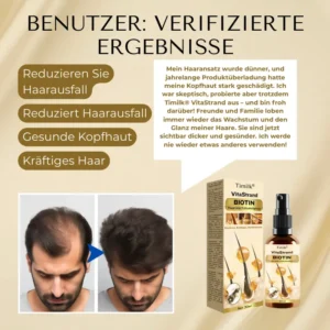 Timilk® VitaStrand Biotin Haarwachstumsspray✅Dichtes, glänzendes Haar in nur wenigen Wochen