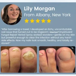 Glowrizon® OnyxiGuard Fungal Repair Herbal Spray