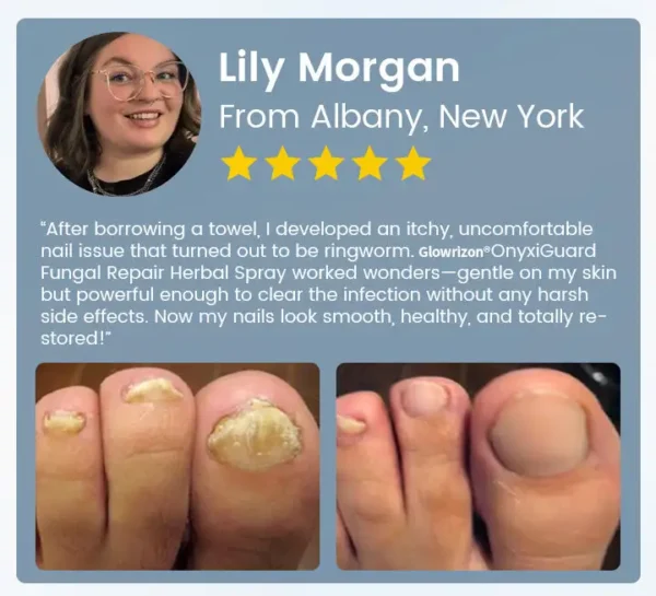 Glowrizon® OnyxiGuard Fungal Repair Herbal Spray