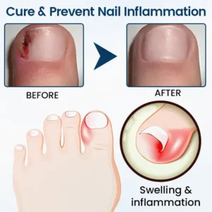 Glowrizon® OnyxiGuard Fungal Repair Herbal Spray