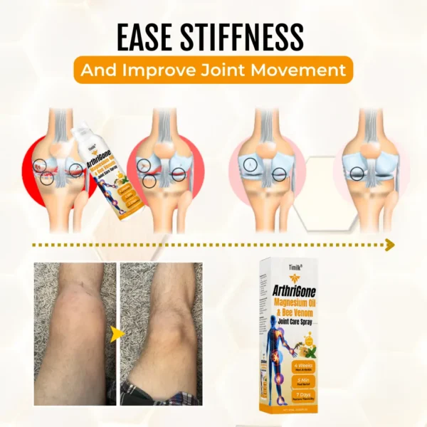 Timilk® ArthriGone Magnesium Oil & Bee Venom Joint Care Spray⭐
