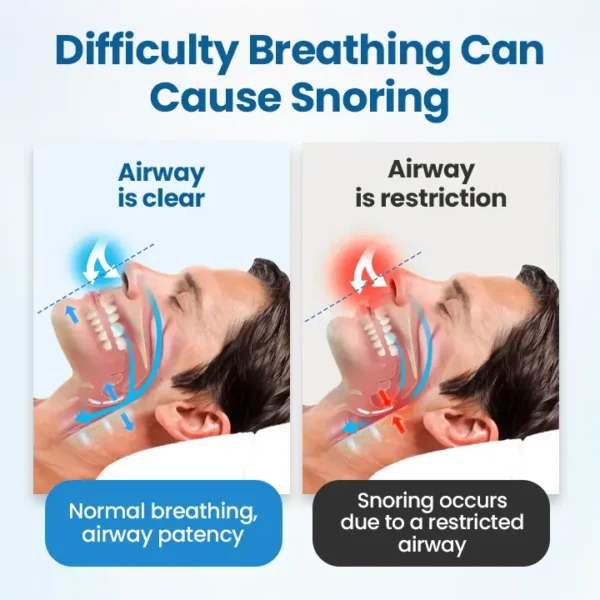 Timilk® SnoreLess Nasal Breather