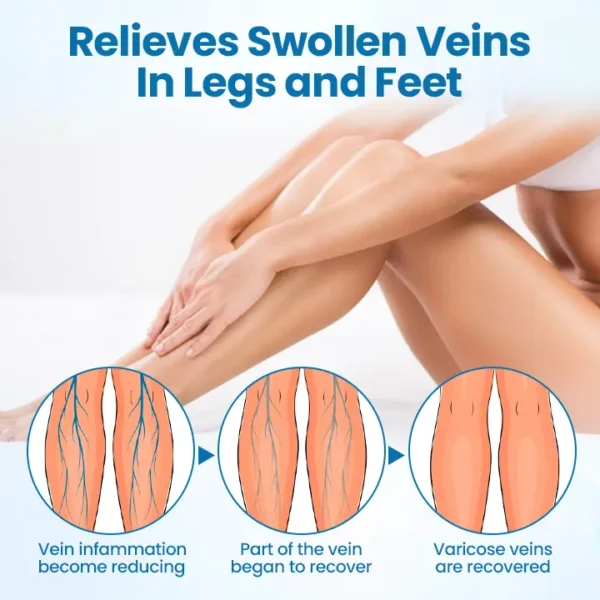 Timilk® VeinGuard Herbal Spray - Clinically Proven to Eliminate Varicose Veins in Just 7 Days!