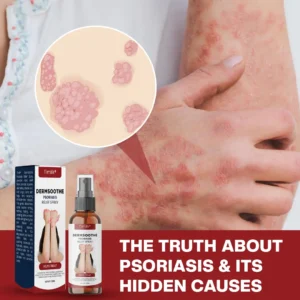 Timilk® DermSoothe Psoriasis Relief Spray