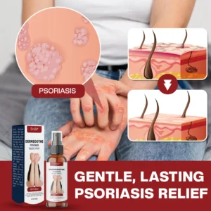 Timilk® DermSoothe Psoriasis Relief Spray