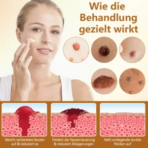 Timilk® BeeErase Multi-Aktions Erneuerungscrem