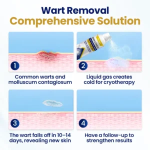 Timilk® ChillErase Bump Renewal Spray🌟 𝖱𝖺𝗉𝗂𝖽 𝗋𝖾𝖼𝗈𝗏𝖾𝗋𝗒 𝗂𝗇 𝟩-𝟣𝟦 𝖽𝖺𝗒𝗌!