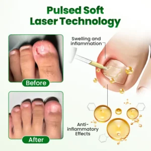 Timilk® HerbaNail 7-Day Repair Serum 🔥 FDA Certified (Clinically Proven Herbal Formula for 7-Day Nail Fungus Repair & Strength Restoration 🌿)