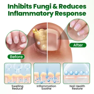 Timilk® HerbaNail 7-Day Repair Serum 🔥 FDA Certified (Clinically Proven Herbal Formula for 7-Day Nail Fungus Repair & Strength Restoration 🌿)