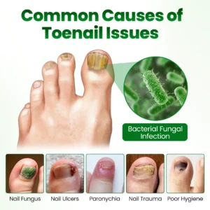 Timilk® HerbaNail 7-Day Repair Serum 🔥 FDA Certified (Clinically Proven Herbal Formula for 7-Day Nail Fungus Repair & Strength Restoration 🌿)