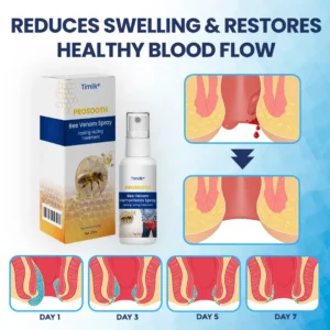 Timilk® ProSooth Bee Venom Hemorrhoids Spray（A）