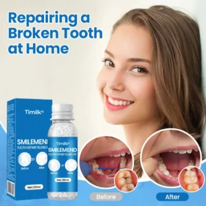 Timilk® SmileMend Tooth Repair Filling Kit