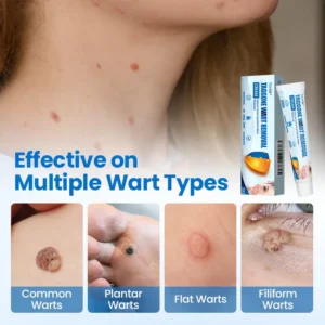 Timilk® TagGone Wart Removal Cream 🔥
