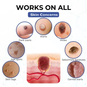 Timilk® VanishPro Skin Spot Removal Cream 🇬🇧 XH-VanishPro-upsell