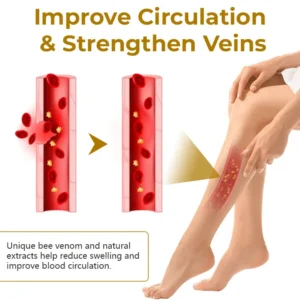 Timilk® VeinClear Bee Venom Cream |✨ Visible Relief in Just 7 Days! 🦵🌿