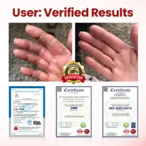 Timilk® VitaGluco Diabetic Care Cream