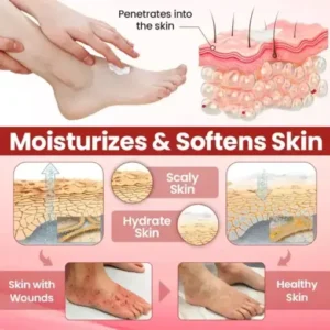 Timilk® VitaGluco Diabetic Care Cream