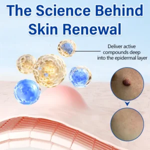 Timilk® WartClear Herbal Ointment 🇬🇧 XH-WartClear-UPSELL