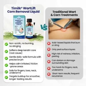 Timilk® WartLift Corn Removal Liquid (new)